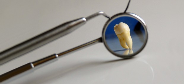 View of tooth in mirror